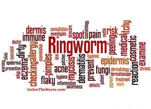 Ringworm