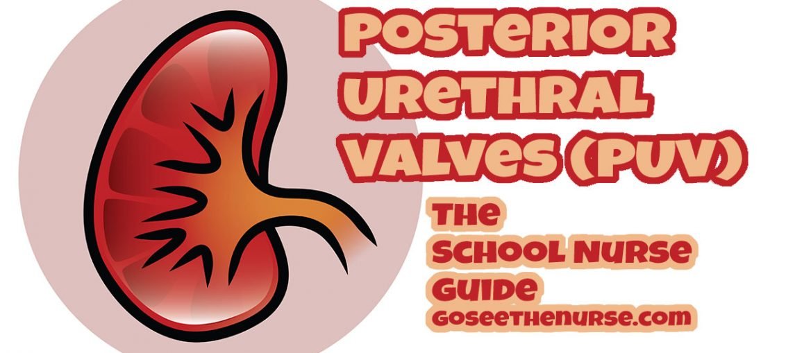 posterior urethral valves